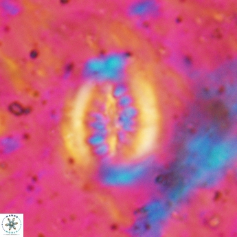 Heterorhabdus actinosus 6180