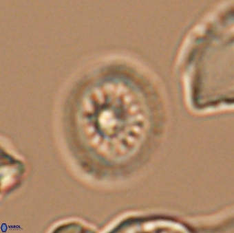 Heterorhabdus actinosus 9295