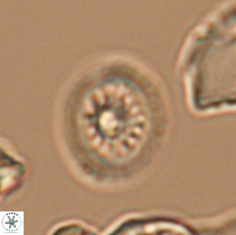 Heterorhabdus actinosus 9295