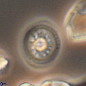 Heterorhabdus actinosus 9296