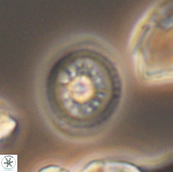 Heterorhabdus actinosus 9296