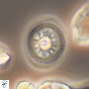 Heterorhabdus actinosus 9297