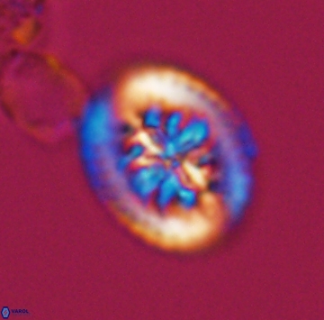 Heterorhabdus actinosus 9927