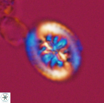 Heterorhabdus actinosus 9927