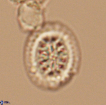 Heterorhabdus actinosus 9934