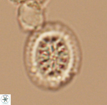 Heterorhabdus actinosus 9934