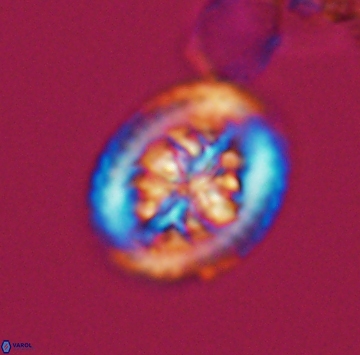 Heterorhabdus actinosus 9931