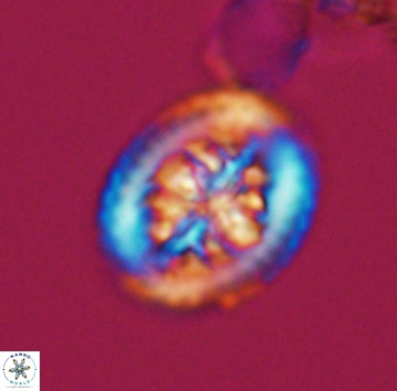 Heterorhabdus actinosus 9931
