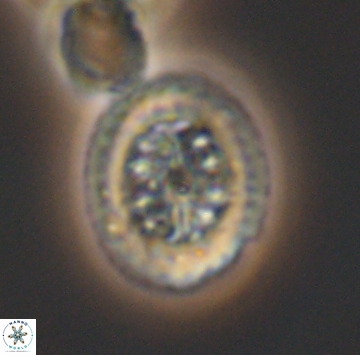 Heterorhabdus actinosus 9932