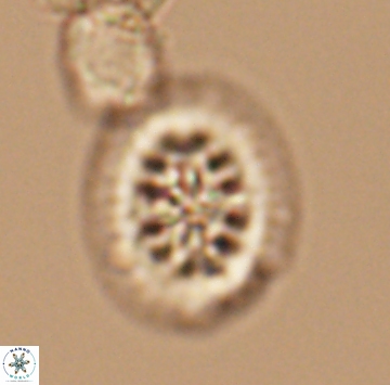 Heterorhabdus actinosus 9933