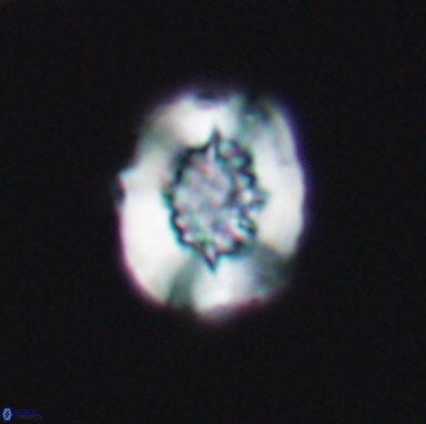 Heterorhabdus actinosus 11511