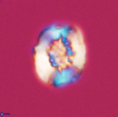 Heterorhabdus actinosus 11512