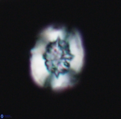 Heterorhabdus actinosus 11515