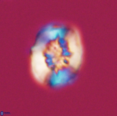 Heterorhabdus actinosus 11516