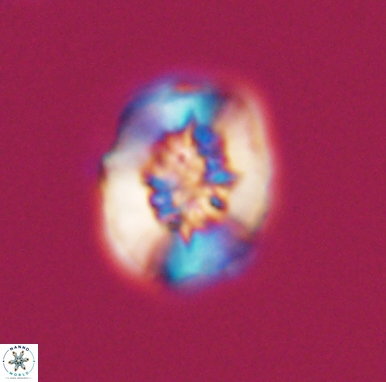 Heterorhabdus actinosus 11516