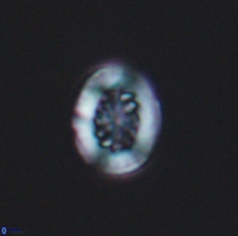 Heterorhabdus actinosus 11751