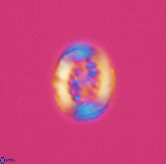 Heterorhabdus actinosus 11752