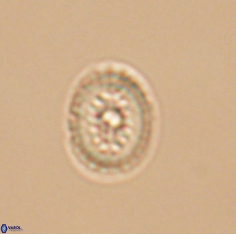 Heterorhabdus actinosus 11757