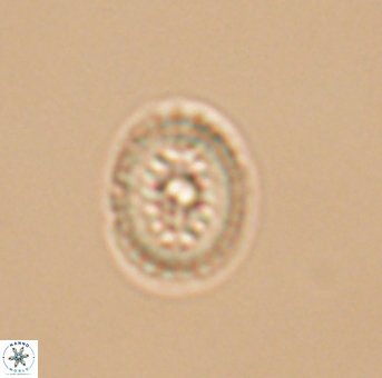 Heterorhabdus actinosus 11757