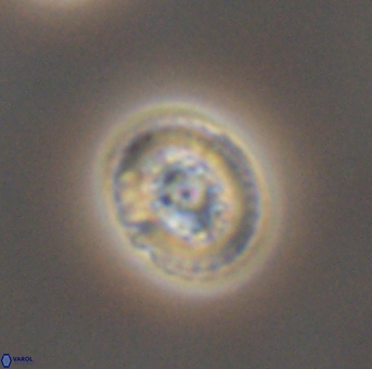 Heterorhabdus actinosus 11758