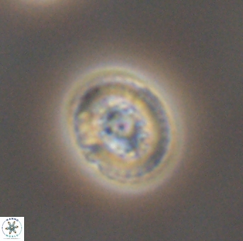 Heterorhabdus actinosus 11758