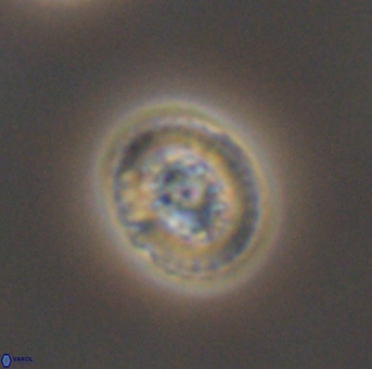 Heterorhabdus actinosus 11759