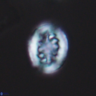 Heterorhabdus actinosus 12240