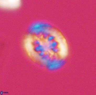 Heterorhabdus actinosus 12243