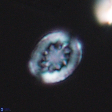 Heterorhabdus actinosus 12244