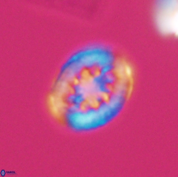 Heterorhabdus actinosus 12245