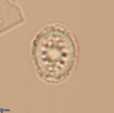 Heterorhabdus actinosus 12246