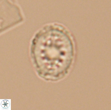 Heterorhabdus actinosus 12246