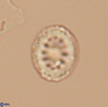 Heterorhabdus actinosus 12247