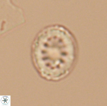 Heterorhabdus actinosus 12247