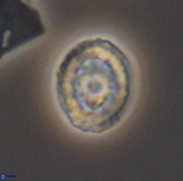 Heterorhabdus actinosus 12248