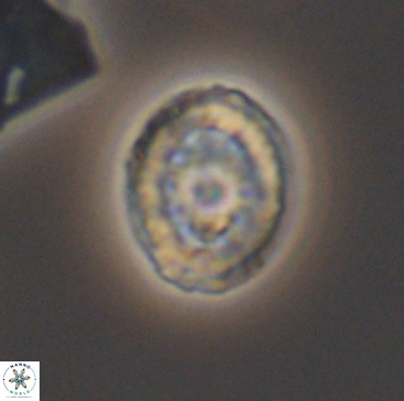 Heterorhabdus actinosus 12248