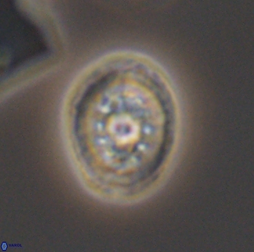 Heterorhabdus actinosus 12237