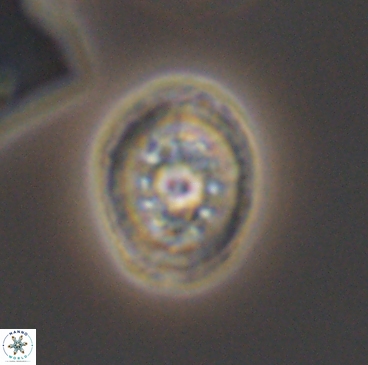 Heterorhabdus actinosus 12237