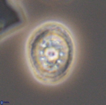 Heterorhabdus actinosus 12238