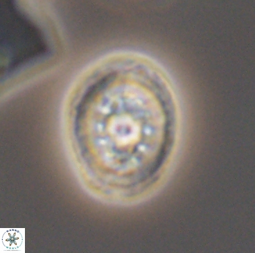 Heterorhabdus actinosus 12238
