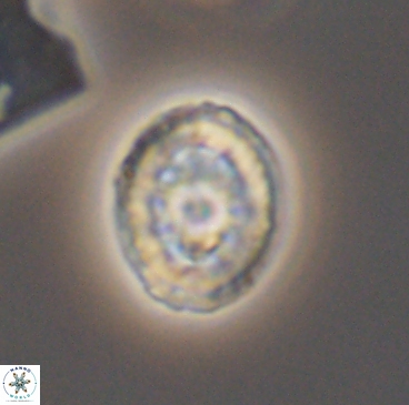 Heterorhabdus actinosus 12239