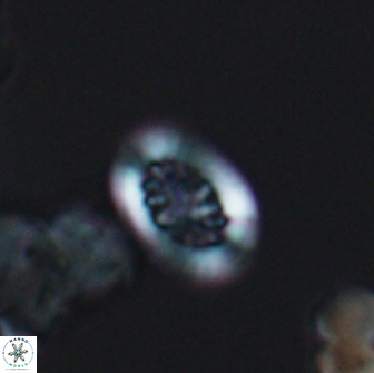 Heterorhabdus actinosus 13110