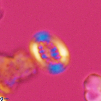 Heterorhabdus actinosus 13111