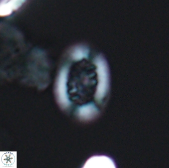 Heterorhabdus actinosus 13112