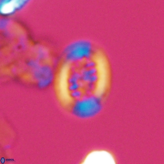 Heterorhabdus actinosus 13113