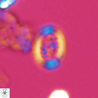 Heterorhabdus actinosus 13113