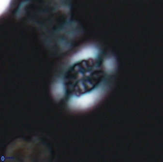 Heterorhabdus actinosus 13114