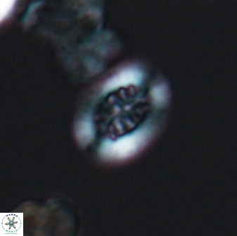 Heterorhabdus actinosus 13114