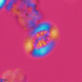 Heterorhabdus actinosus 13115