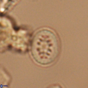 Heterorhabdus actinosus 13116